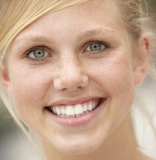 woman with freckles